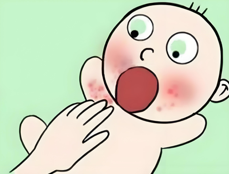 福馨孕产期小贴士：清远宝妈咨询怎么预防婴儿奶廯？